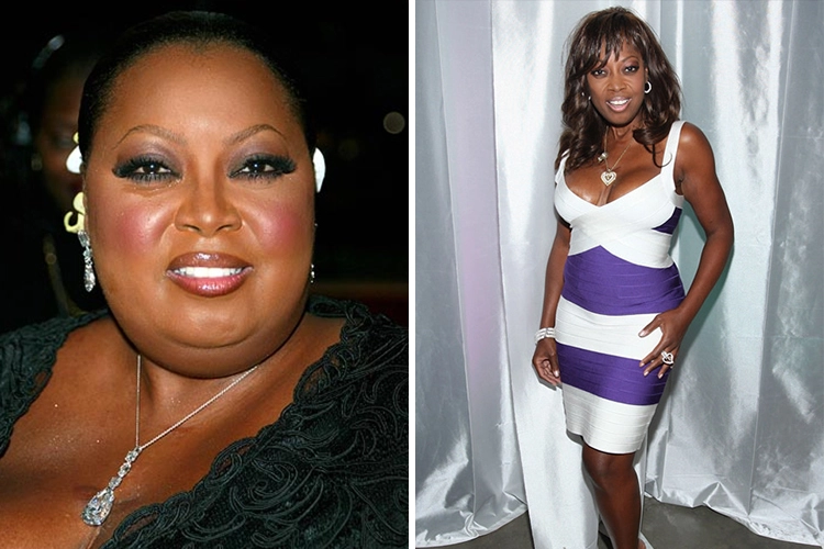 Photo of Star Jones who lost weight after gastric bypass surgery